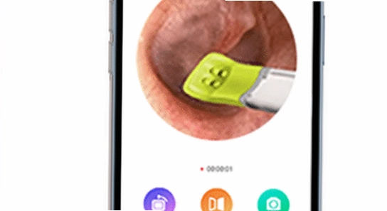 hnd�����Ͷ����豸app���°����ذ�װ,ɫ�ʷḻ ��ˮӡ ����ͼ